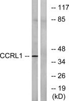 CCRL1 Polyclonal Antibody