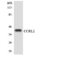 CCRL2 Polyclonal Antibody