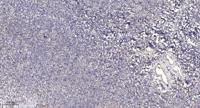 CCS Polyclonal Antibody