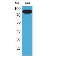 CD10 Polyclonal Antibody