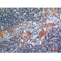 CD116 Polyclonal Antibody