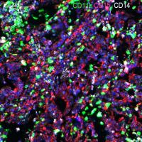 CD11b Polyclonal Antibody