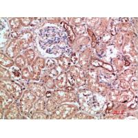 CD11b Polyclonal Antibody