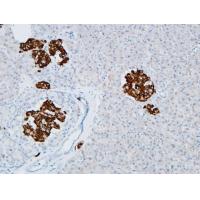 CD133 Polyclonal Antibody