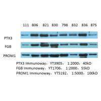 CD133 Polyclonal Antibody