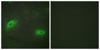 CD137L Polyclonal Antibody