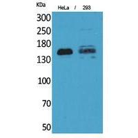 CD148 Polyclonal Antibody