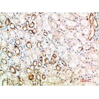 CD152 Polyclonal Antibody
