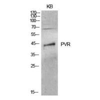 CD155 Polyclonal Antibody