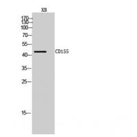 CD155 Polyclonal Antibody