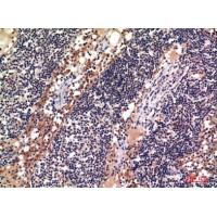 CD156c Polyclonal Antibody