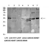 CD158e Polyclonal Antibody