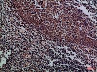 CD158f1/2 Polyclonal Antibody