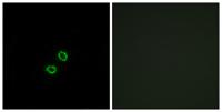 CD158f2 Polyclonal Antibody