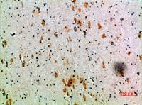 CD158k Polyclonal Antibody