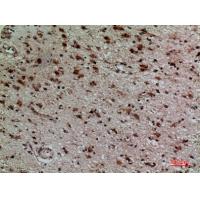 CD158z Polyclonal Antibody