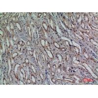 CD159a/c Polyclonal Antibody