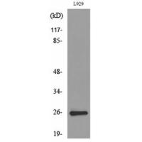 CD159a/c Polyclonal Antibody