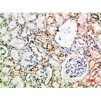 CD16 Polyclonal Antibody