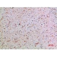 CD16 Polyclonal Antibody