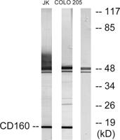 CD160 Polyclonal Antibody