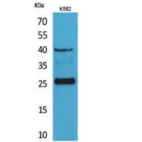 CD161 Polyclonal Antibody