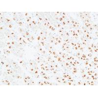 CD166 Polyclonal Antibody