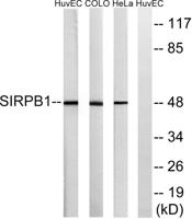 CD172b Polyclonal Antibody