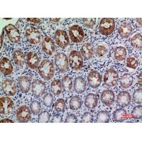 CD177 Polyclonal Antibody