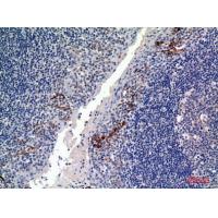 CD19 Polyclonal Antibody