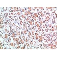 CD1B Polyclonal Antibody