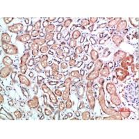 CD1B Polyclonal Antibody