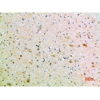 CD1B Polyclonal Antibody