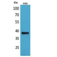 CD1C Polyclonal Antibody