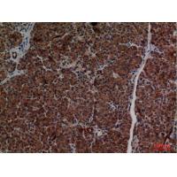 CD1D Polyclonal Antibody