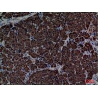 CD1E Polyclonal Antibody