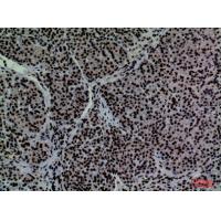 CD2 Polyclonal Antibody