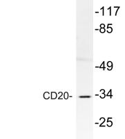 CD20 Polyclonal Antibody