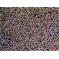 CD201 Polyclonal Antibody