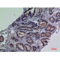CD203c Polyclonal Antibody