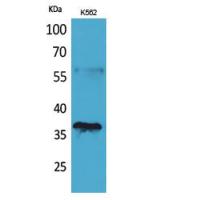 CD207 Polyclonal Antibody