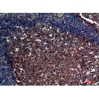 CD21 Polyclonal Antibody