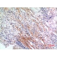 CD225 Polyclonal Antibody