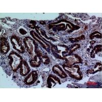 CD229 Polyclonal Antibody
