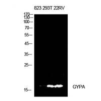CD235a Polyclonal Antibody