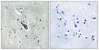 Robo2 Polyclonal Antibody