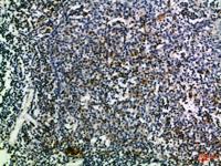 PD-L1 Polyclonal Antibody