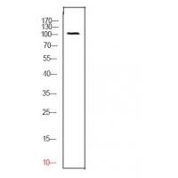 CD276 Polyclonal Antibody