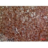 CD276 Polyclonal Antibody