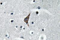 CD284 Polyclonal Antibody